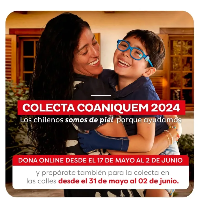 Hoy inicia la Colecta de COANIQUEM para apoyar la rehabilitación gratuita de niñas y adolescentes afectados por quemaduras y otras cicatrices Hoy inicia la Colecta de COANIQUEM para apoyar la rehabilitación gratuita de niñas y adolescentes afectados por quemaduras y otras cicatrices