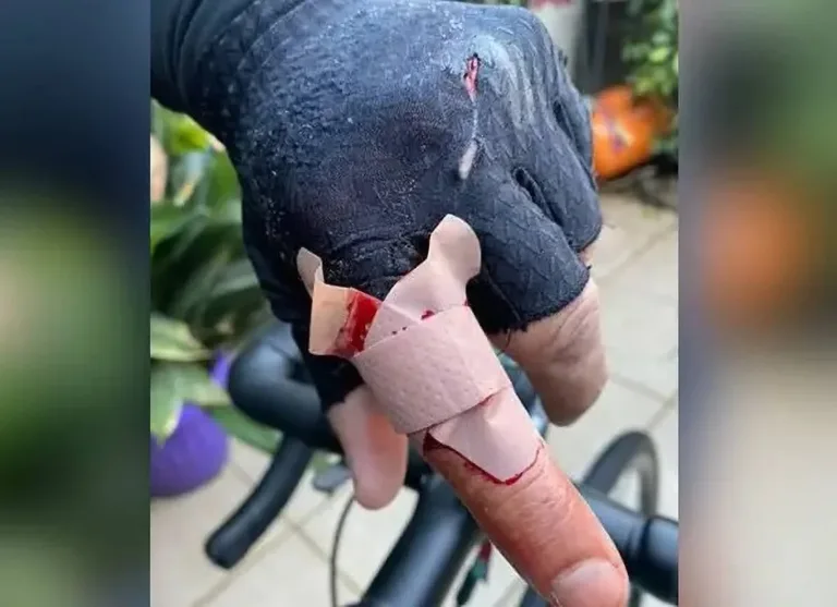 Denuncian graves accidentes por uso de hilo curado en las cercanías del aeródromo de Curicó