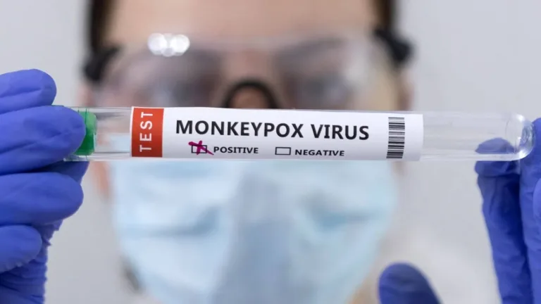 En Suecia se detectó el primer caso de Mpox (Viruela del Mono) fuera de África