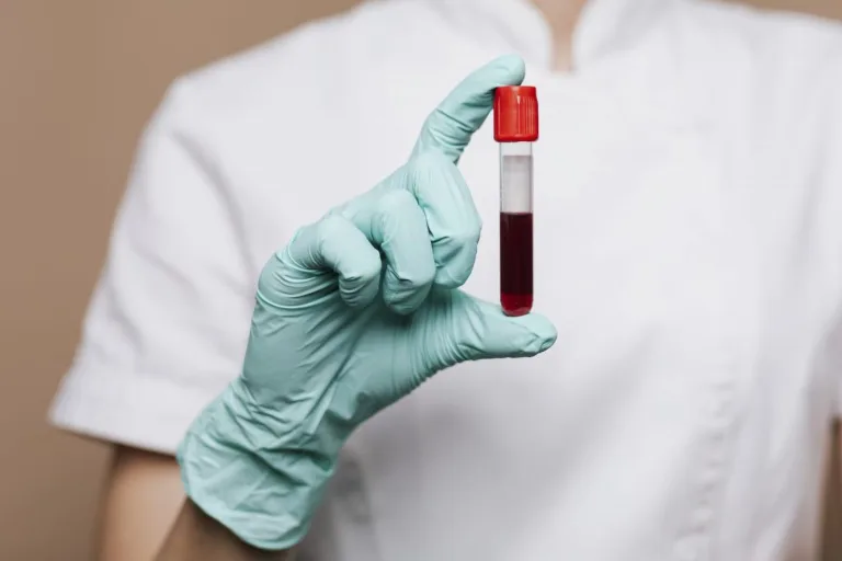 Especialistas advierten sobre la falta de hierro y sus efectos en la salud