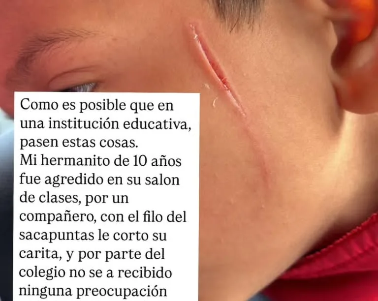 Agresión a escolar en la Escuela Palestina de Curicó deja a estudiante herido en su rostro